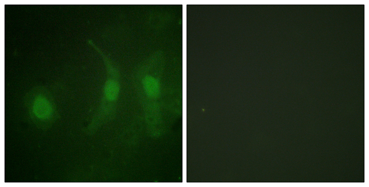 IRF3 Antibody - Immunofluorescence analysis of HeLa cells, using IRF-3 (Phospho-Ser385) Antibody. The picture on the right is blocked with the phospho peptide.