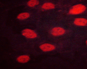 IRF3 Antibody - Staining HeLa cells by IF/ICC. The samples were fixed with PFA and permeabilized in 0.1% saponin prior to blocking in 10% serum for 45 min at 37°C. The primary antibody was diluted 1/400 and incubated with the sample for 1 hour at 37°C. A Alexa Fluor 594 conjugated goat polyclonal to rabbit IgG (H+L), diluted 1/600 was used as secondary antibody.