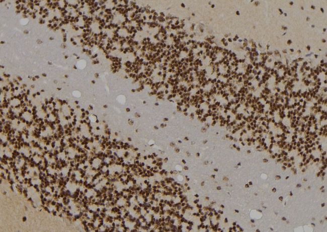 IRF3 Antibody - 1:100 staining rat brain tissue by IHC-P. The sample was formaldehyde fixed and a heat mediated antigen retrieval step in citrate buffer was performed. The sample was then blocked and incubated with the antibody for 1.5 hours at 22°C. An HRP conjugated goat anti-rabbit antibody was used as the secondary.