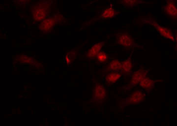 IRF3 Antibody - Staining HT29 cells by IF/ICC. The samples were fixed with PFA and permeabilized in 0.1% Triton X-100, then blocked in 10% serum for 45 min at 25°C. The primary antibody was diluted at 1:200 and incubated with the sample for 1 hour at 37°C. An Alexa Fluor 594 conjugated goat anti-rabbit IgG (H+L) Ab, diluted at 1/600, was used as the secondary antibody.