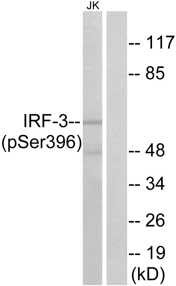 IRF3 Antibody - Western blot analysis of lysates from Jurkat cells treated with EGF 200ng/ml 30', using IRF-3 (Phospho-Ser396) Antibody. The lane on the right is blocked with the phospho peptide.