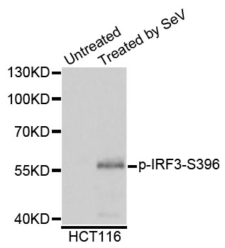 IRF3 Antibody - Western blot analysis of extracts of HCT116 cells.