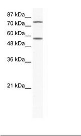 IRF4 Antibody - Jurkat Cell Lysate.  This image was taken for the unconjugated form of this product. Other forms have not been tested.