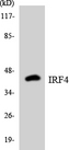 IRF4 Antibody - Western blot analysis of the lysates from HT-29 cells using IRF4 antibody.