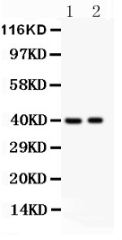 IRF4 Antibody - MUM1 antibody Western blot. All lanes: Anti MUM1 at 0.5 ug/ml. Lane 1: HELA Whole Cell Lysate at 40 ug. Lane 2: JURKAT Whole Cell Lysate at 40 ug. Predicted band size: 51 kD. Observed band size: 40 kD.