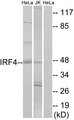 IRF4 Antibody - Western blot analysis of lysates from HeLa and Jurkat cells, using IRF4 Antibody. The lane on the right is blocked with the synthesized peptide.