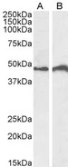 IRF4 Antibody - IRF4 antibody (0.5µg/ml) staining of Daudi (A) and Jurkat (B) cell lysate (35µg protein in RIPA buffer). Detected by chemiluminescence.