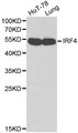 IRF4 Antibody - Western blot of IRF4 pAb in extracts from HuT-78 cells and mouse lung tissue.