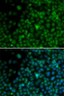 IRF4 Antibody - Immunofluorescence analysis of U2OS cells using IRF4 antibody. Blue: DAPI for nuclear staining.