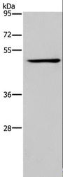 IRF4 Antibody - Western blot analysis of Jurkat cell, using IRF4 Polyclonal Antibody at dilution of 1:400.