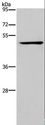 IRF4 Antibody - Western blot analysis of Jurkat cell, using IRF4 Polyclonal Antibody at dilution of 1:400.