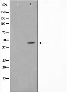 IRF4 Antibody - Western blot analysis on HeLa cell lysates using IRF4 antibody. The lane on the left is treated with the antigen-specific peptide.