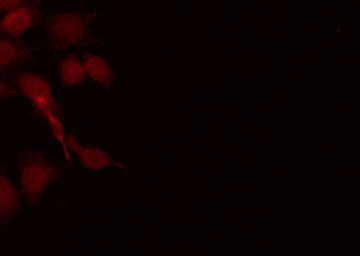 IRF4 Antibody - Staining HeLa cells by IF/ICC. The samples were fixed with PFA and permeabilized in 0.1% Triton X-100, then blocked in 10% serum for 45 min at 25°C. The primary antibody was diluted at 1:200 and incubated with the sample for 1 hour at 37°C. An Alexa Fluor 594 conjugated goat anti-rabbit IgG (H+L) Ab, diluted at 1/600, was used as the secondary antibody.