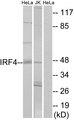 IRF4 Antibody - Western blot analysis of extracts from HeLa cells and Jurkat cells, using IRF4 antibody.