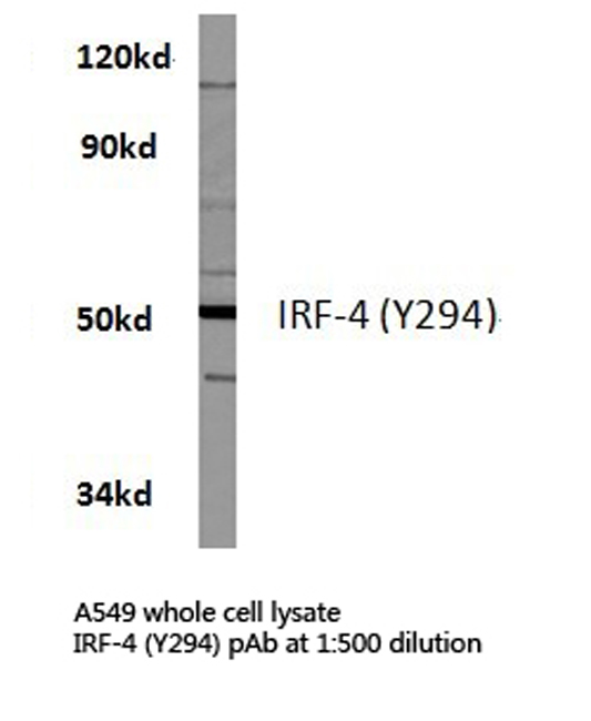 IRF4 Antibody - Western blot of IRF-4 (Y294) pAb in extracts from A549 cells.