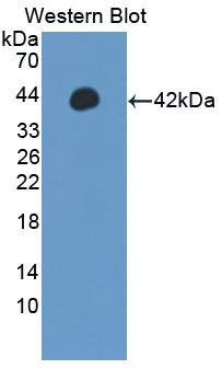 IRF5 Antibody - Western blot of IRF5 antibody.