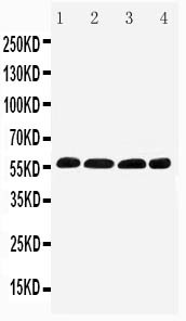 IRF5 Antibody - WB of IRF5 antibody. Lane 1: Human Placenta Tissue Lysate. Lane 2: Rat Thymus Tissue Lysate. Lane 3: Rat Kidney Tissue Lysate. Lane 4: Rat Ovary Tissue Lysate.