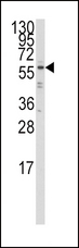 IRF5 Antibody - Western blot of anti-IRF5 Antibody in Ramos cell line lysates (35 ug/lane). IRF5 (arrow) was detected using the purified antibody.