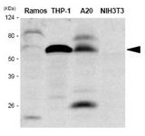 IRF5 Antibody - The extracts of Ramos, THP-1, A20 and NIH3T3 were resolved by SDS-PAGE, transferred to PVDF membrane and probed with anti-human IRF5antibody (1:1000). Proteins were visualized using a goat anti-mouse secondary antibody conjugated to HRP and an ECL detection system.