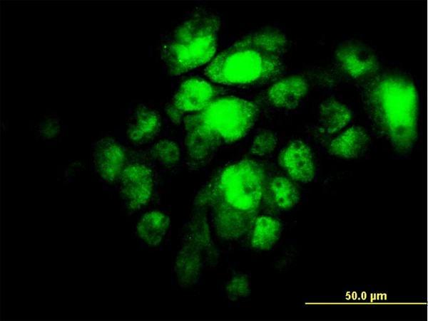 IRF5 Antibody - Immunofluorescence of monoclonal antibody to IRF5 on A-431 cell. [antibody concentration 10 ug/ml]