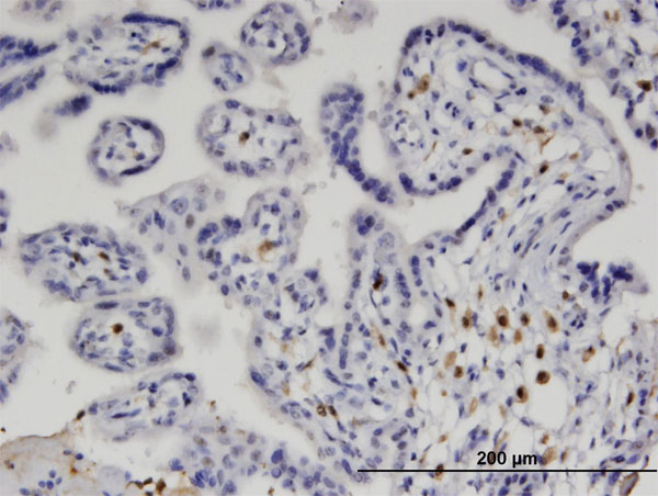 IRF5 Antibody - Immunoperoxidase of monoclonal antibody to IRF5 on formalin-fixed paraffin-embedded human placenta. [antibody concentration 1.5 ug/ml]
