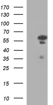 IRF5 Antibody - HEK293T cells were transfected with the pCMV6-ENTRY control (Left lane) or pCMV6-ENTRY IRF5 (Right lane) cDNA for 48 hrs and lysed. Equivalent amounts of cell lysates (5 ug per lane) were separated by SDS-PAGE and immunoblotted with anti-IRF5.