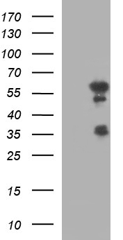 IRF5 Antibody - HEK293T cells were transfected with the pCMV6-ENTRY control (Left lane) or pCMV6-ENTRY IRF5 (Right lane) cDNA for 48 hrs and lysed. Equivalent amounts of cell lysates (5 ug per lane) were separated by SDS-PAGE and immunoblotted with anti-IRF5.