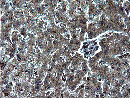 IRF5 Antibody - IHC of paraffin-embedded Human liver tissue using anti-IRF5 mouse monoclonal antibody. (Heat-induced epitope retrieval by 1 mM EDTA in 10mM Tris, pH8.5, 120°C for 3min).