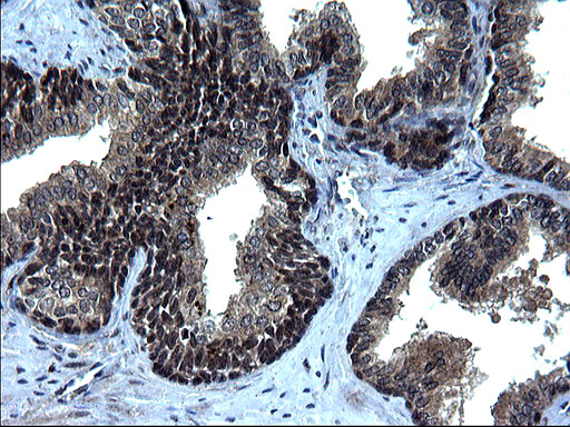 IRF5 Antibody - IHC of paraffin-embedded Human prostate tissue using anti-IRF5 mouse monoclonal antibody. (Heat-induced epitope retrieval by 1 mM EDTA in 10mM Tris, pH8.5, 120°C for 3min).