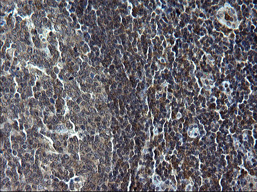 IRF5 Antibody - IHC of paraffin-embedded Human lymph node tissue using anti-IRF5 mouse monoclonal antibody. (Heat-induced epitope retrieval by 1 mM EDTA in 10mM Tris, pH8.5, 120°C for 3min).