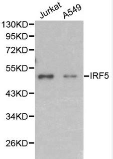 IRF5 Antibody - Western blot of IRF5 pAb in extracts from Jurkat and A549 cells.