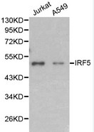 IRF5 Antibody - Western blot of IRF5 pAb in extracts from Jurkat and A549 cells.