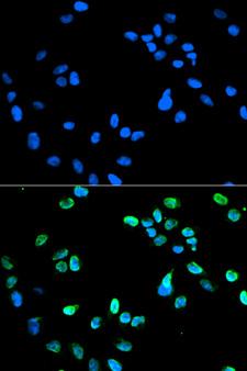 IRF5 Antibody - Immunofluorescence analysis of HeLa cells using IRF5 antibody. Blue: DAPI for nuclear staining.