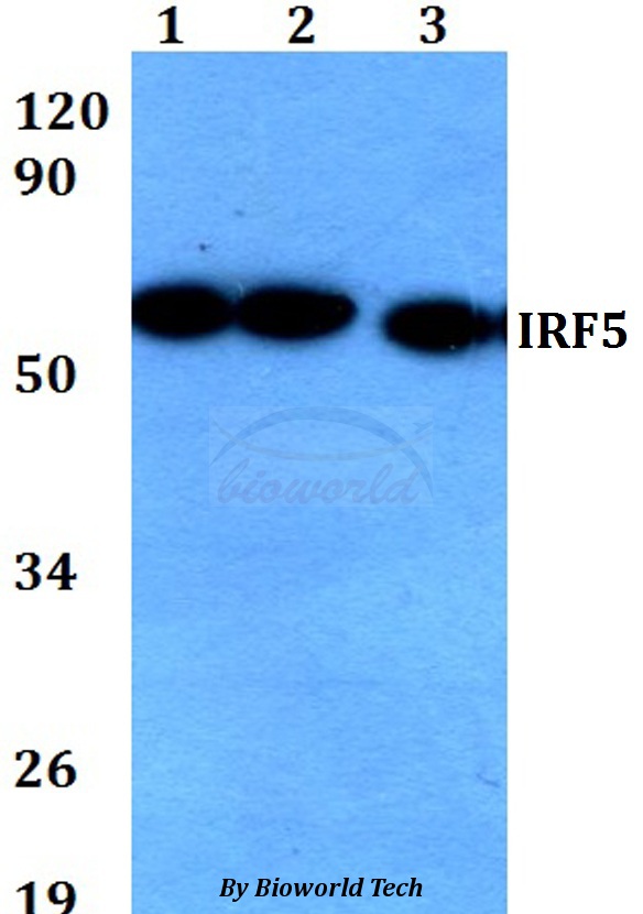 IRF5 Antibody - Western blot of IRF5 antibody at 1:500 dilution. Lane 1: HEK293T whole cell lysate. Lane 2: Raw264.7 whole cell lysate. Lane 3: PC12 whole cell lysate.
