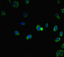 IRF5 Antibody - Immunofluorescent analysis of Hela cells diluted at 1:100 and Alexa Fluor 488-congugated AffiniPure Goat Anti-Rabbit IgG(H+L)