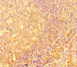 IRF5 Antibody - Immunohistochemistry of paraffin-embedded human tonsil tissue at dilution 1:100