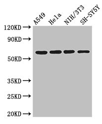 IRF5 Antibody - Western Blot Positive WB detected in:A549 whole cell lysate,Hela whole cell lysate,NIH/3T3 whole cell lysate,SH-SY5Y whole cell lysate All Lanes: IRF5 antibody at 3ug/ml Secondary Goat polyclonal to rabbit IgG at 1/50000 dilution Predicted band size: 57,58,55,48,18 kDa Observed band size: 57 kDa