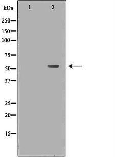 IRF5 Antibody - Western blot analysis of HeLa whole cells lysates using IRF5 antibody. The lane on the left is treated with the antigen-specific peptide.