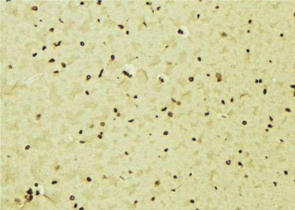 IRF5 Antibody - 1:100 staining mouse brain tissue by IHC-P. The sample was formaldehyde fixed and a heat mediated antigen retrieval step in citrate buffer was performed. The sample was then blocked and incubated with the antibody for 1.5 hours at 22°C. An HRP conjugated goat anti-rabbit antibody was used as the secondary.