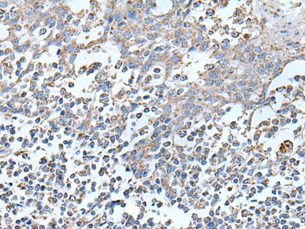 IRF5 Antibody - Immunohistochemistry of paraffin-embedded Human tonsil tissue  using IRF5 Polyclonal Antibody at dilution of 1:25(×200)