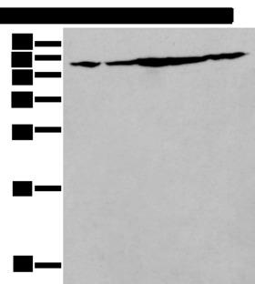 IRF5 Antibody - Western blot analysis of NIH/3T3 Hela Jurkat Hepg2 and A549 cell lysates  using IRF5 Polyclonal Antibody at dilution of 1:250