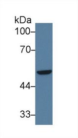 IRF6 Antibody - Western Blot; Sample: Human A549 cell lysate; Primary Ab: 3µg/ml Rabbit Anti-Human IRF6 Antibody Second Ab: 0.2µg/mL HRP-Linked Caprine Anti-Rabbit IgG Polyclonal Antibody
