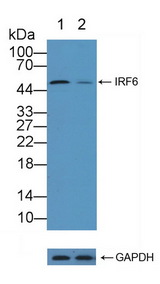 IRF6 Antibody - Knockout Varification: Lane 1: Wild-type MCF7 cell lysate; Lane 2: IRF6 knockout MCF7 cell lysate; Predicted MW: 53,42kd Observed MW: 53kd Primary Ab: 2µg/ml Rabbit Anti-Human IRF6 Antibody Second Ab: 0.2µg/mL HRP-Linked Caprine Anti-Rabbit IgG Polyclonal Antibody
