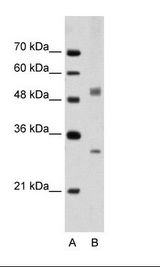 IRF6 Antibody - A: Marker, B: Jurkat Cell Lysate.  This image was taken for the unconjugated form of this product. Other forms have not been tested.