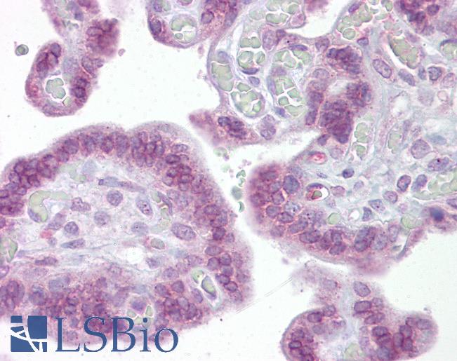 IRF6 Antibody - Anti-IRF6 antibody IHC of human placenta. Immunohistochemistry of formalin-fixed, paraffin-embedded tissue after heat-induced antigen retrieval. Antibody concentration 5 ug/ml.  This image was taken for the unconjugated form of this product. Other forms have not been tested.