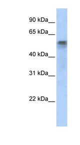 IRF6 Antibody - IRF6 antibody Western blot of Transfected 293T cell lysate. This image was taken for the unconjugated form of this product. Other forms have not been tested.