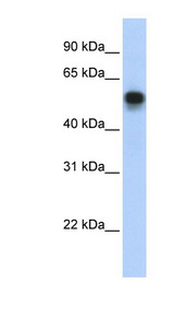 IRF6 Antibody - IRF6 antibody Western blot of Transfected 293T cell lysate. This image was taken for the unconjugated form of this product. Other forms have not been tested.