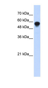 IRF6 Antibody - IRF6 antibody Western blot of Transfected 293T cell lysate. This image was taken for the unconjugated form of this product. Other forms have not been tested.