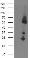 IRF6 Antibody - HEK293T cells were transfected with the pCMV6-ENTRY control (Left lane) or pCMV6-ENTRY IRF6 (Right lane) cDNA for 48 hrs and lysed. Equivalent amounts of cell lysates (5 ug per lane) were separated by SDS-PAGE and immunoblotted with anti-IRF6.