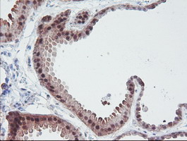 IRF6 Antibody - IHC of paraffin-embedded Human breast tissue using anti-IRF6 mouse monoclonal antibody.